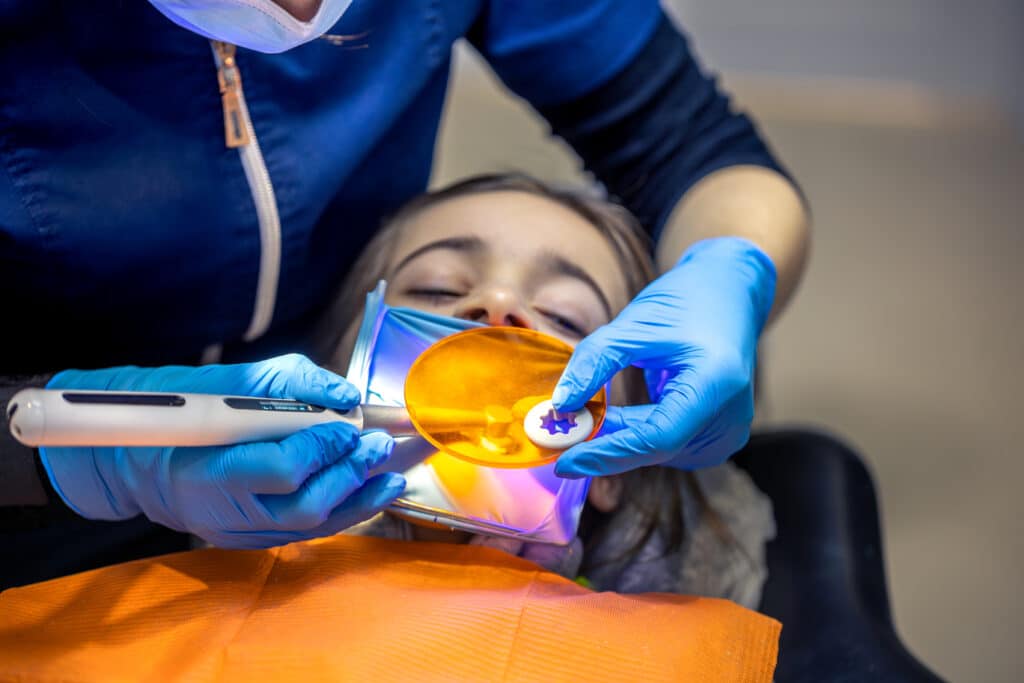 Dental Fillings treatment in North Fort Myers