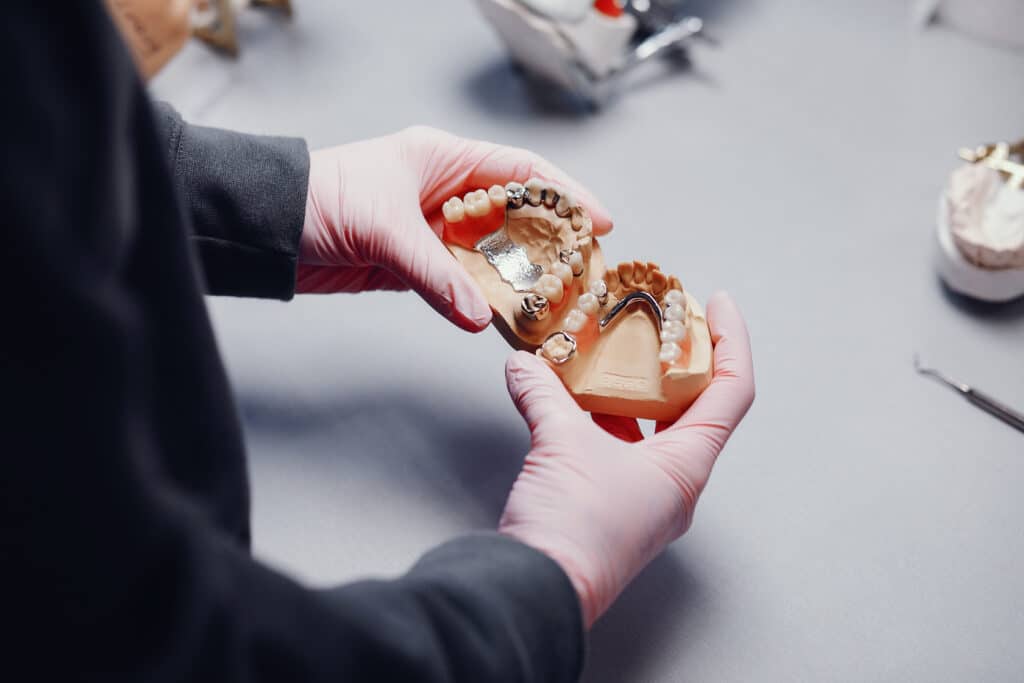 Implant Supported Dentures treatment in North Fort Myers