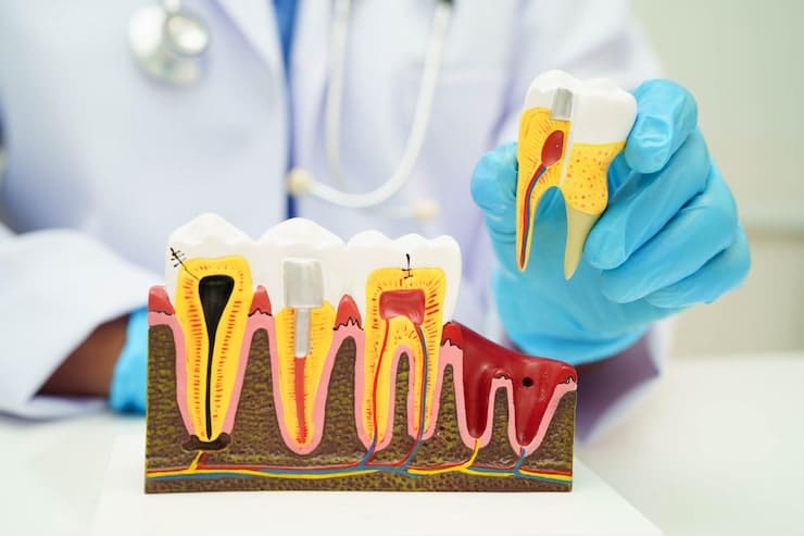 Gum Treatment treatment in North Fort Myers