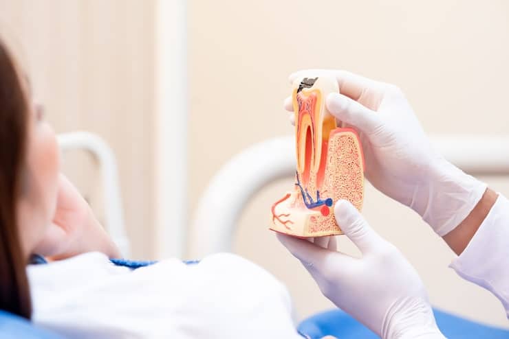 Root Canals treatment in North Fort Myers
